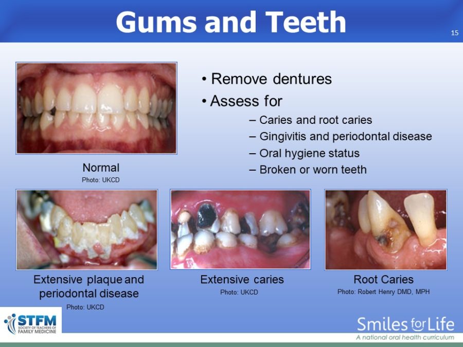 Module 8 Slide 15