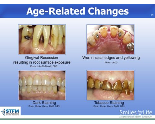 Module 8 Slide 16