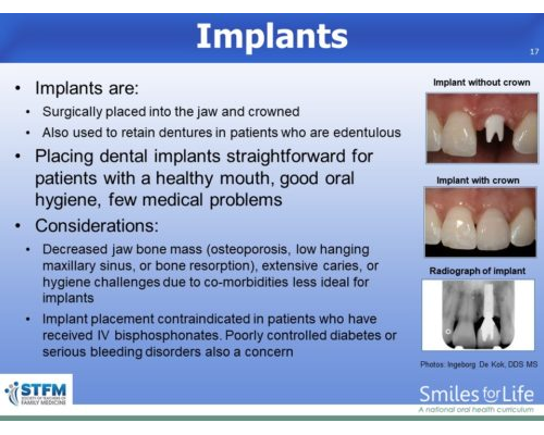 Module 8 Slide 17