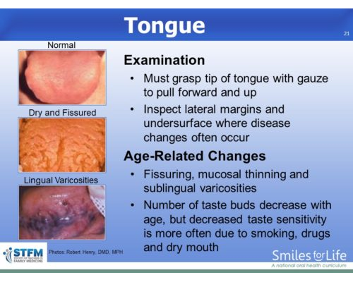 Module 8 Slide 21