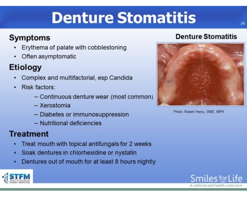 Module 8 Slide 24