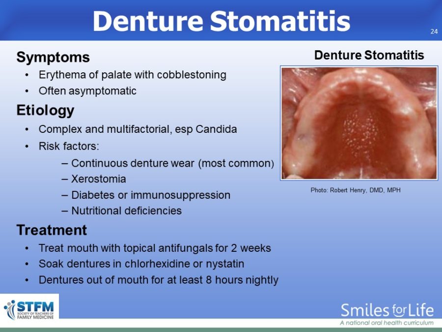 Module 8 Slide 24