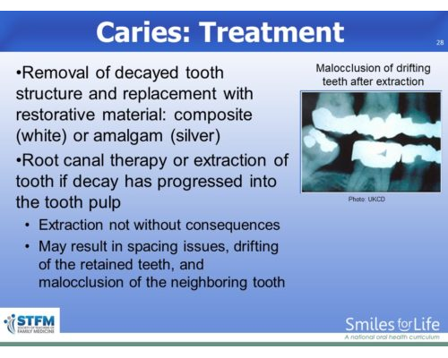 Module 8 Slide 28