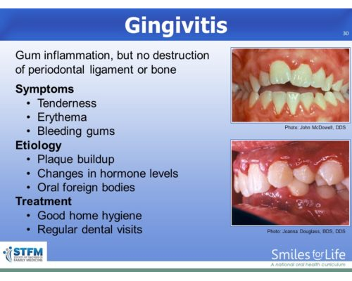 Module 8 Slide 30