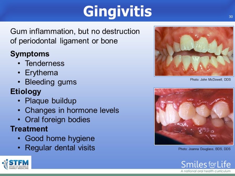 Module 8 Slide 30