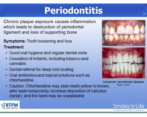 Module 8 Slide 31