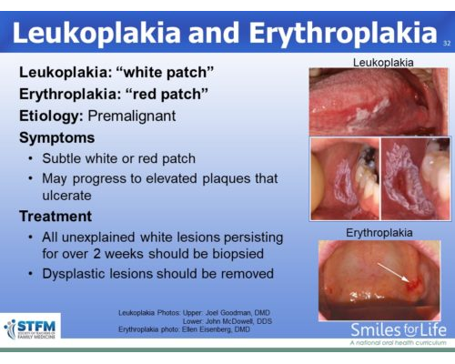 Module 8 Slide 32