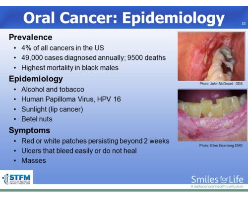 Module 8 Slide 33