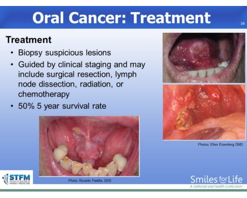 Module 8 Slide 34