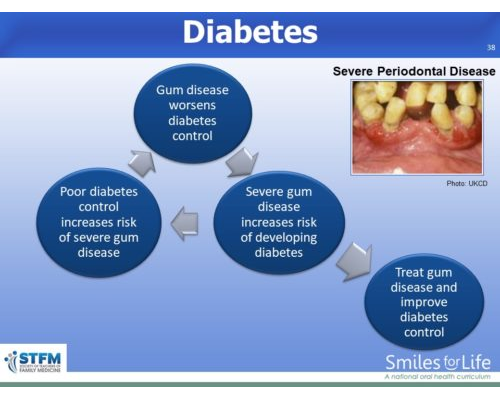 Module 8 Slide 38