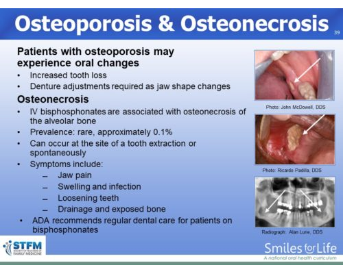 Module 8 Slide 39