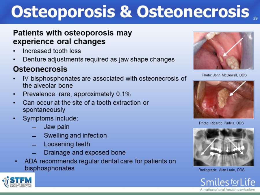 Module 8 Slide 39