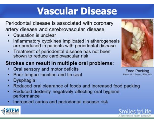 Module 8 Slide 41