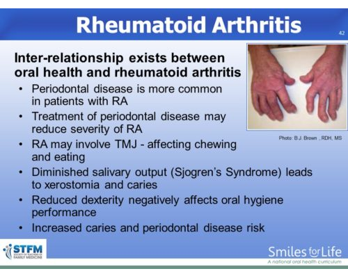 Module 8 Slide 42