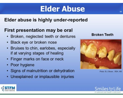 Module 8 Slide 60