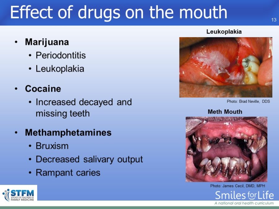 Module 1 Slide 13