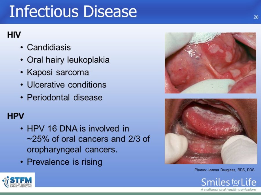 Module 1 Slide 28